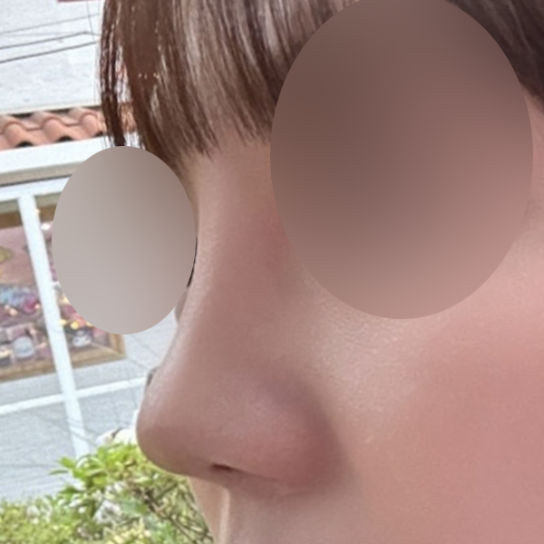수술 전 후