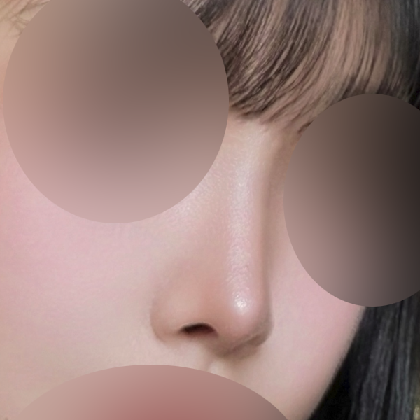 수술 전 후