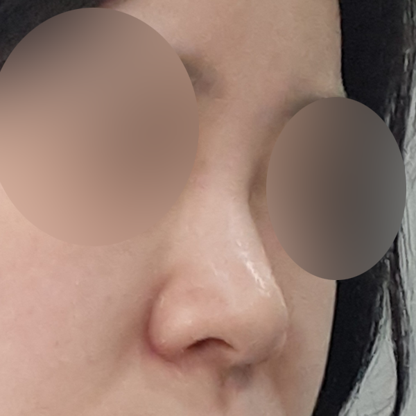 수술 전 후