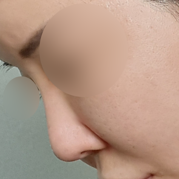 수술 전 후