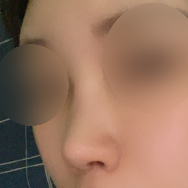 수술 전 후