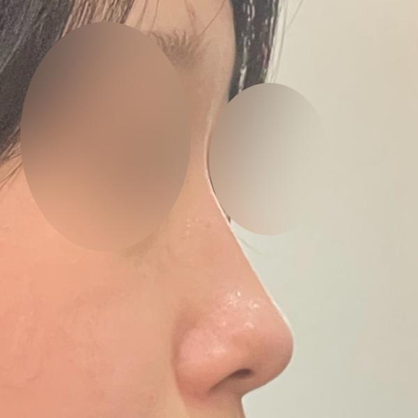 수술 전 후