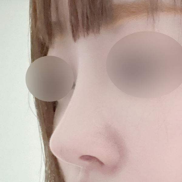 수술 전 후