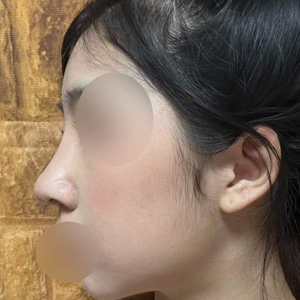 수술 전 후