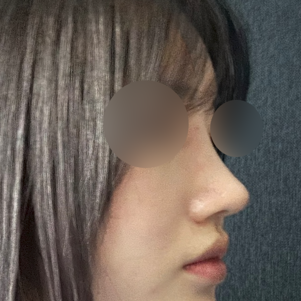 수술 전 후