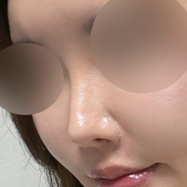 수술 전 후