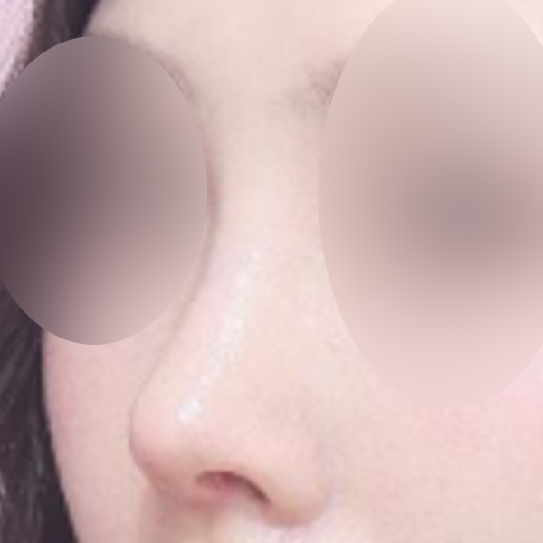 수술 전 후