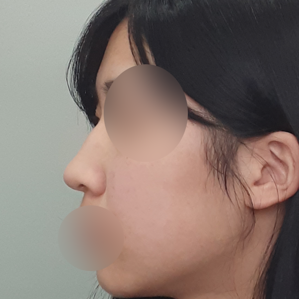 수술 전 후
