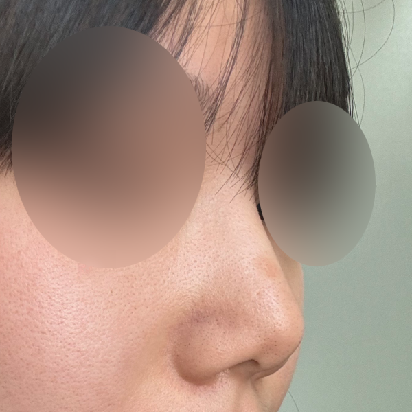 수술 전 후