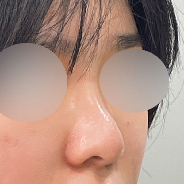 수술 전 후