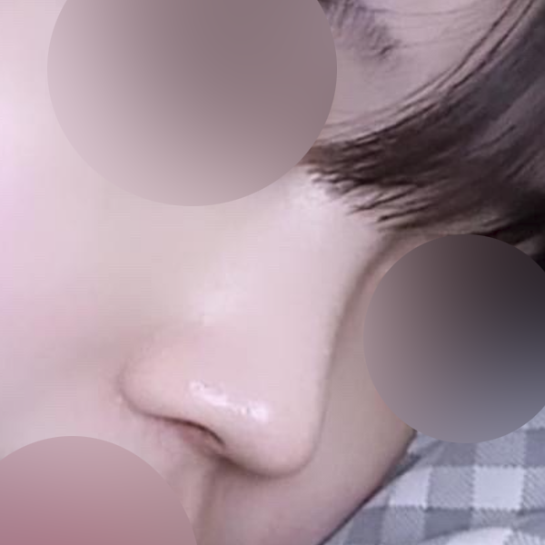 수술 전 후
