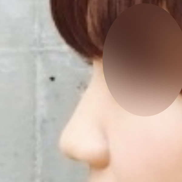 수술 전 후