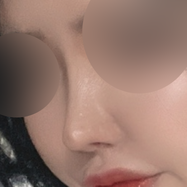 수술 전 후