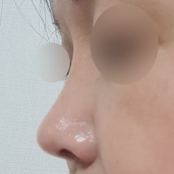 수술 전 후