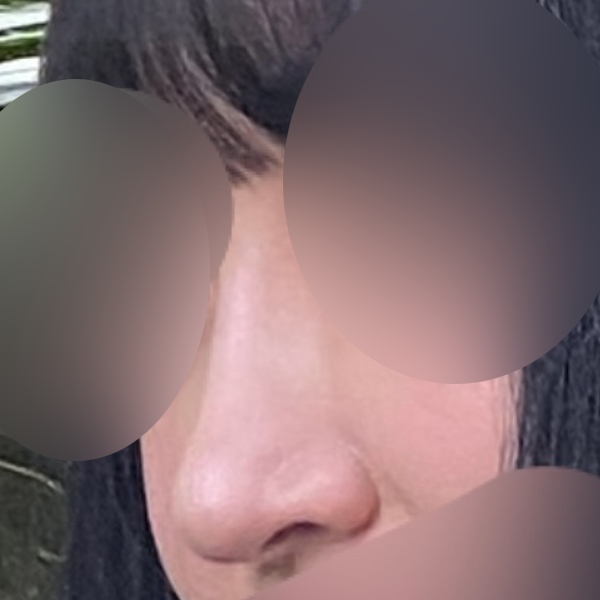 수술 전 후