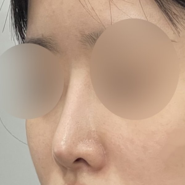 수술 전 후